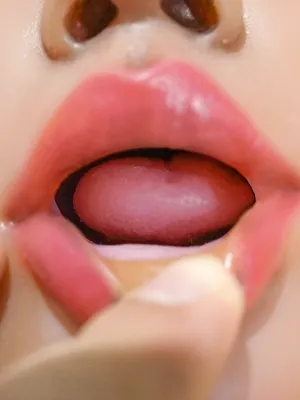 開口
